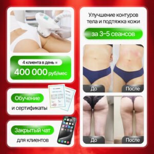 Аппарат для вакуумно-роликового массажа AnchorFree V8C2 4