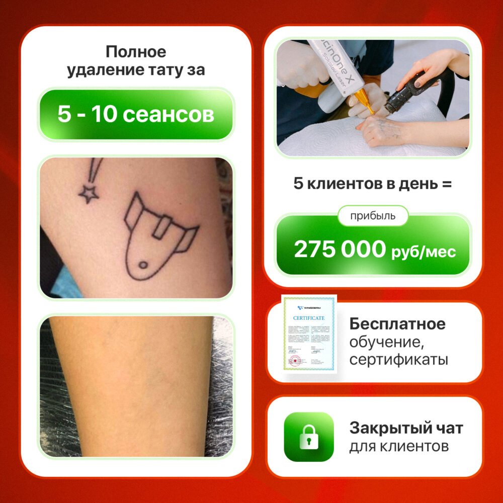 Лазер для удаления тату ScinOne X 4