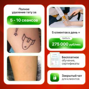 Лазер для удаления тату ScinOne X 4